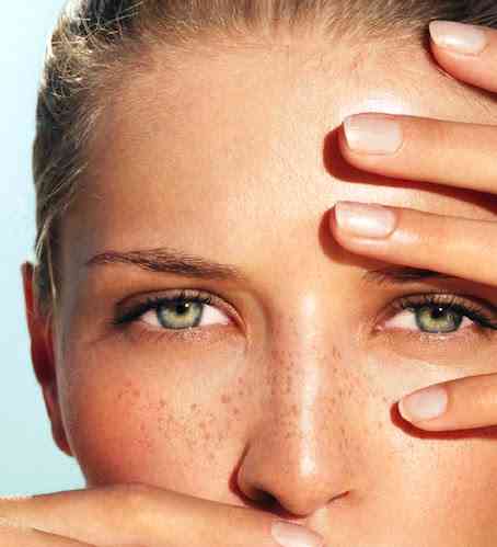 cum sa ne ferim de arsurile solare