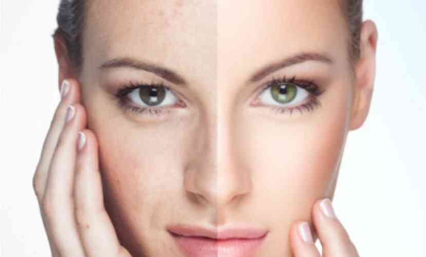 remedii naturale pete piele