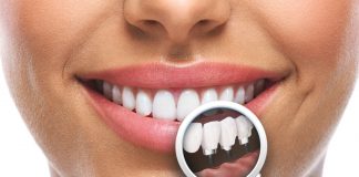 Care este cel mai bun implant dentar?