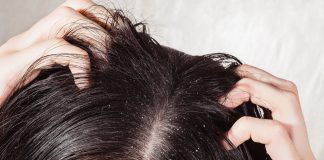 Cele mai eficiente soluții împotriva mătreții