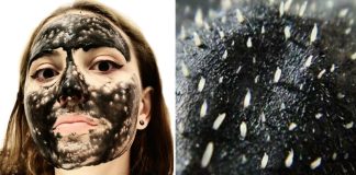 Cum sa faci benzi pentru a elimina punctele negre acasa