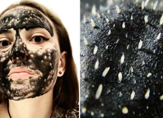 Cum sa faci benzi pentru a elimina punctele negre acasa