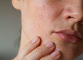 Cea mai buna rutina de ingrijire a pielii pentru pielea sensibila